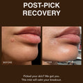 Pore Choices — Plant-Based Mucin Repair Mist with Totarol