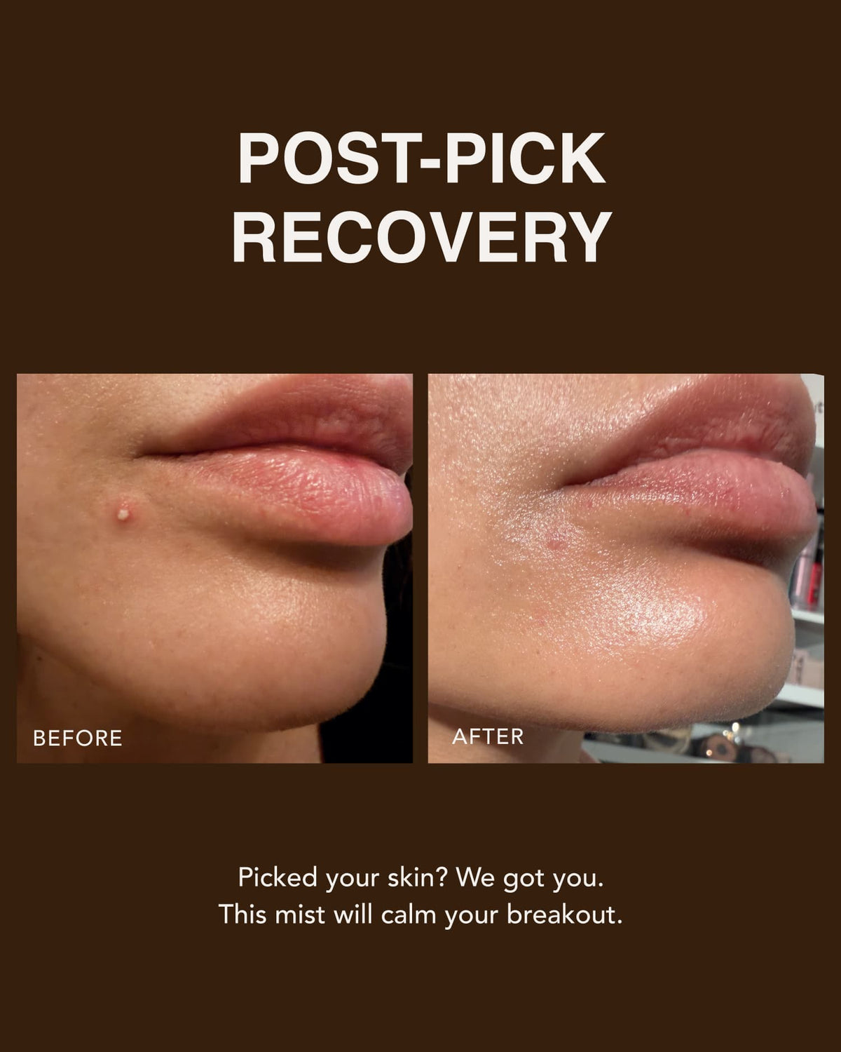 Pore Choices — Plant-Based Mucin Repair Mist with Totarol