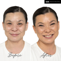 The Concealer